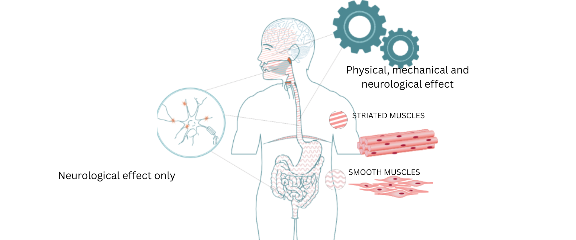 Neurological effects diagram